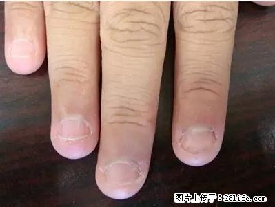 剪指甲、挖耳屎，这些日常小动作竟隐藏大危害！ - 商丘生活资讯 - 商丘28生活网 sq.28life.net